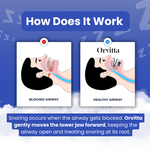 Orvitta SilentForm™