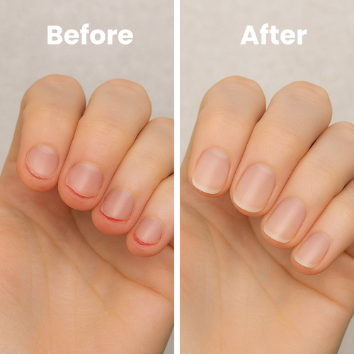 Orvitta™ Nail Care Pro
