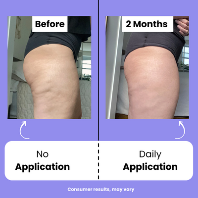 Orvitta™ Sculpt & Tone Cream
