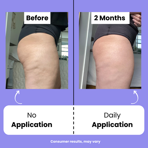 Orvitta™ Sculpt & Tone Cream