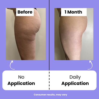 Orvitta™ Sculpt & Tone Cream