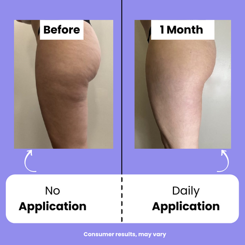 Orvitta™ Sculpt & Tone Cream
